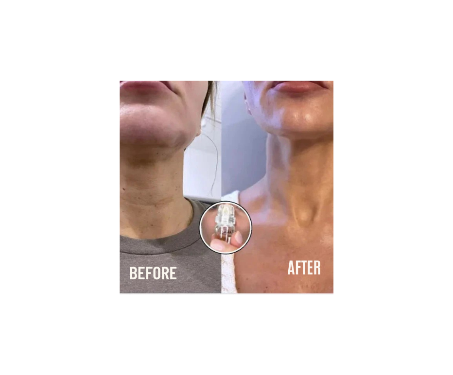 Firming Micro Needle Facial Serum